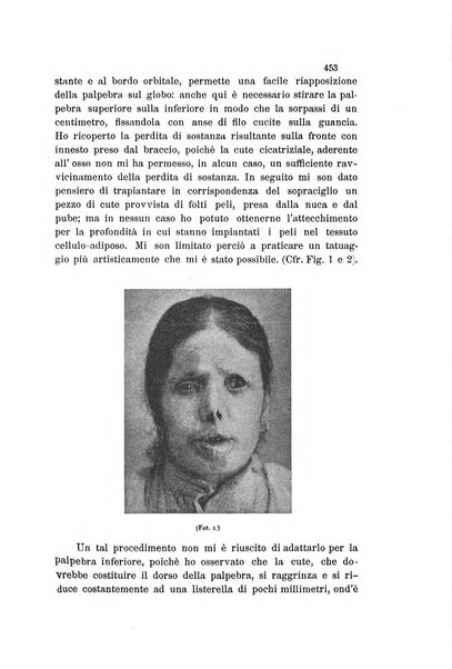 La Clinica oculistica periodico mensile per i medici pratici