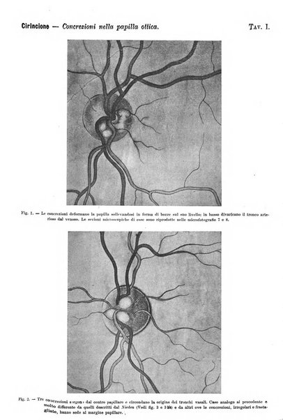 La Clinica oculistica periodico mensile per i medici pratici