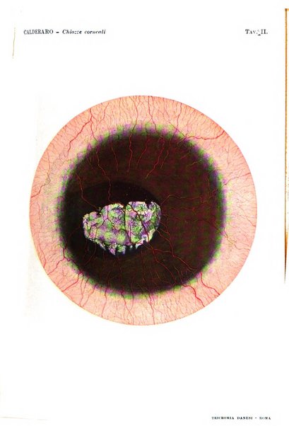 La Clinica oculistica periodico mensile per i medici pratici