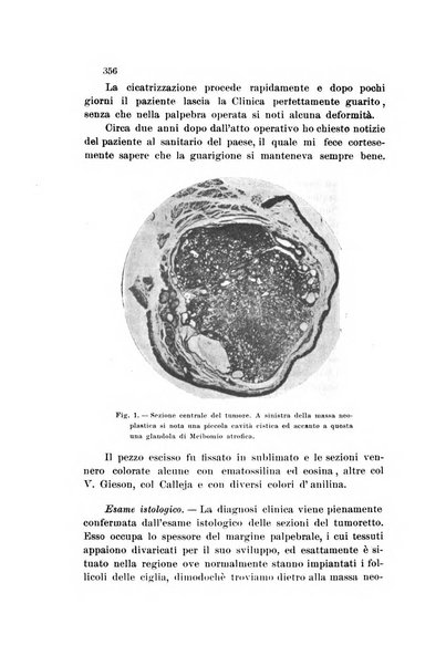 La Clinica oculistica periodico mensile per i medici pratici