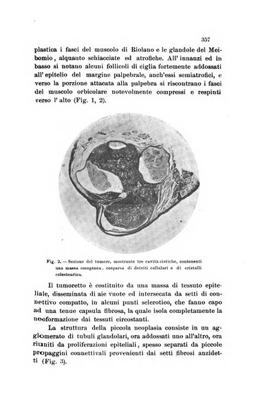 La Clinica oculistica periodico mensile per i medici pratici