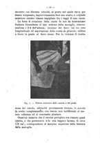 giornale/TO00306585/1917/unico/00000101