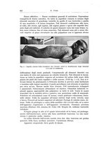 giornale/TSA0036894/1935/unico/00000476