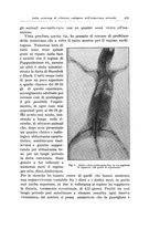 giornale/TSA0036894/1937/unico/00000503