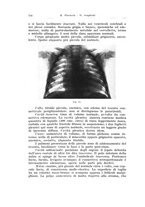 giornale/TSA0036894/1938/unico/00000126