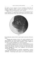 giornale/TSA0036961/1935/unico/00000155