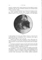 giornale/TSA0036961/1935/unico/00000172