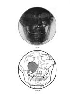 giornale/TSA0036961/1935/unico/00000500