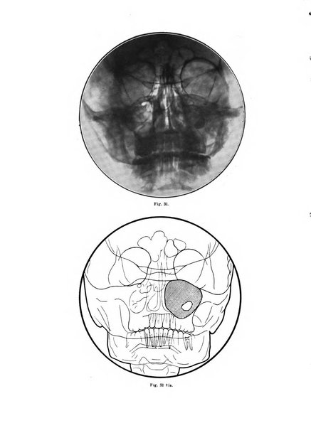 Archivum chirurgiae oris