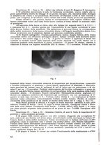 giornale/TSA0046866/1944/unico/00000062