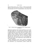 giornale/UFI0040156/1914/unico/00000034