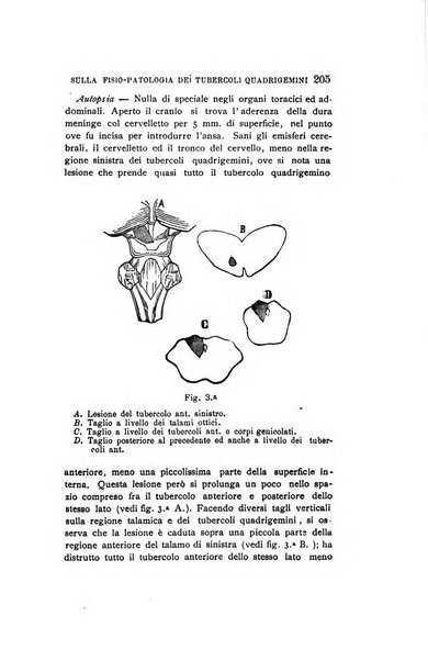 Il manicomio moderno giornale di psichiatria