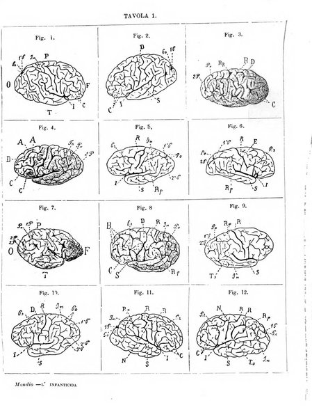 Il manicomio archivio di psichiatria e scienze affini