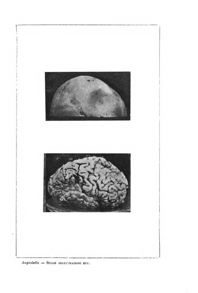 Il manicomio archivio di psichiatria e scienze affini