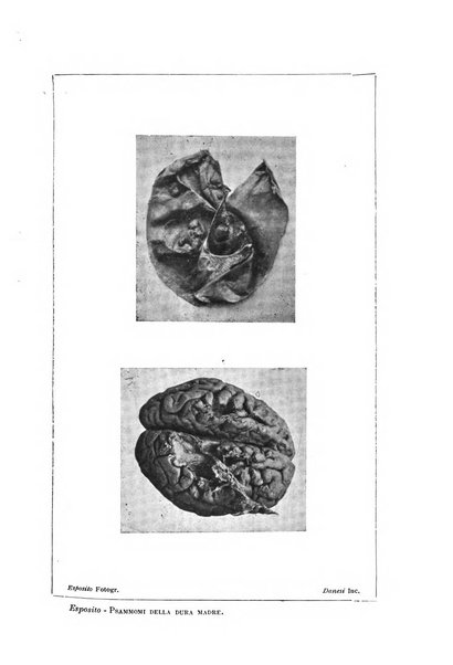 Il manicomio archivio di psichiatria e scienze affini