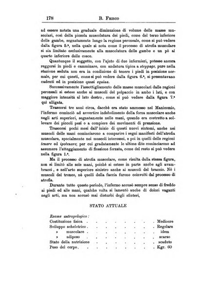 Il manicomio archivio di psichiatria e scienze affini