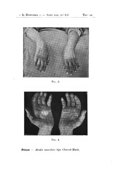 Il manicomio archivio di psichiatria e scienze affini