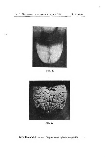 Il manicomio archivio di psichiatria e scienze affini