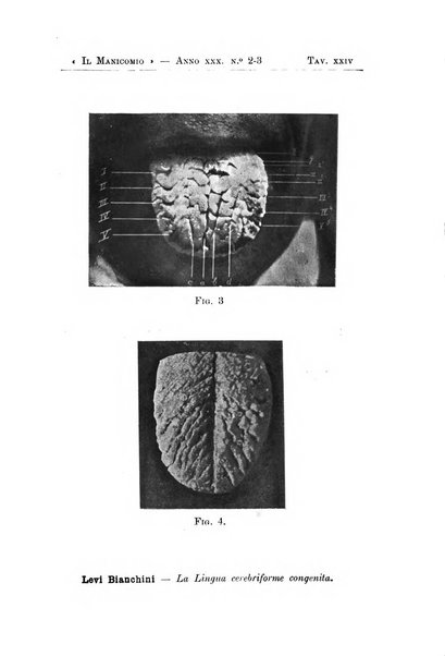 Il manicomio archivio di psichiatria e scienze affini