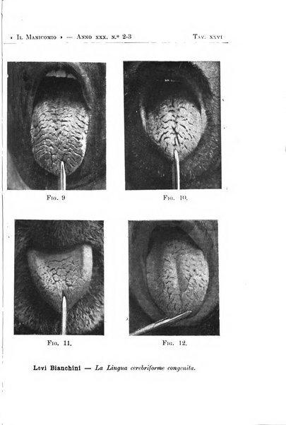 Il manicomio archivio di psichiatria e scienze affini