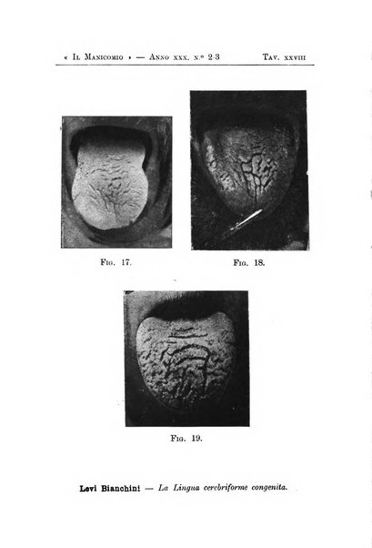 Il manicomio archivio di psichiatria e scienze affini