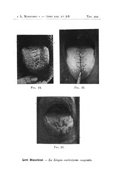 Il manicomio archivio di psichiatria e scienze affini