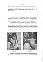 giornale/UFI0041293/1917-1918/unico/00000116