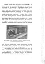 giornale/UFI0053376/1917/unico/00000079