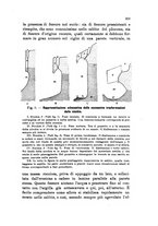 giornale/UFI0147478/1909/unico/00000249