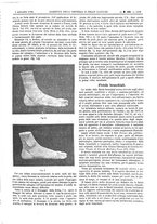 giornale/UM10002936/1894/unico/00001147