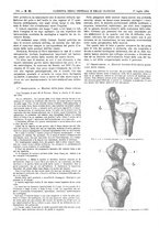 giornale/UM10002936/1904/V.25.2/00000094