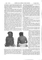 giornale/UM10002936/1911/V.32.1/00000512