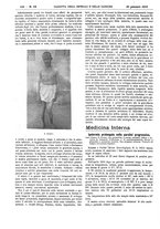 giornale/UM10002936/1912/V.33.1/00000154