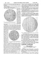 giornale/UM10002936/1912/V.33.1/00000320