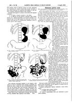 giornale/UM10002936/1912/V.33.2/00000026
