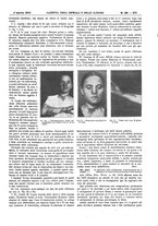 giornale/UM10002936/1913/V.34.1/00000293
