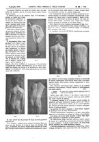 giornale/UM10002936/1913/V.34.1/00000741