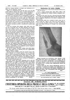 giornale/UM10002936/1913/V.34.2/00000512