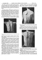giornale/UM10002936/1916/V.37.1/00000083