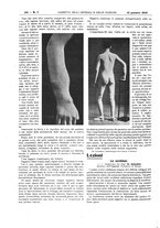 giornale/UM10002936/1916/V.37.1/00000146