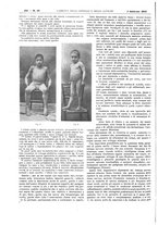 giornale/UM10002936/1916/V.37.1/00000212