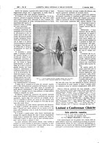 giornale/UM10002936/1924/unico/00000232