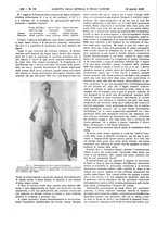 giornale/UM10002936/1928/unico/00000434