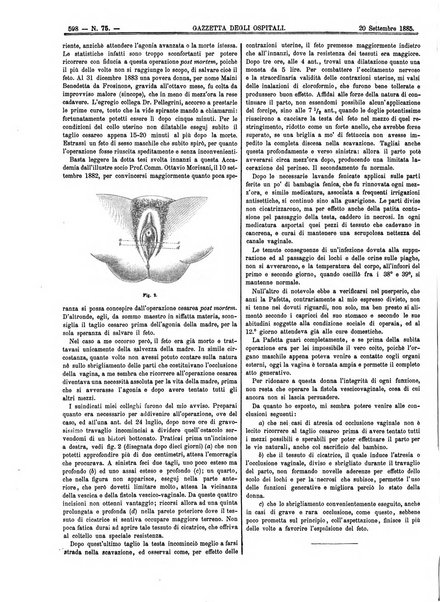 Gazzetta degli ospitali officiale per la pubblicazione degli atti del Consiglio degli Istituti ospitalieri di Milano