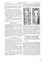 giornale/UM10003666/1893/V.14.1/00000348
