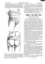 giornale/UM10003666/1893/V.14.1/00000402