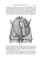 giornale/UM10004251/1925/unico/00000941