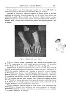giornale/UM10004251/1926/unico/00000285