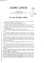 giornale/UM10004251/1928/unico/00000011