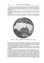 giornale/UM10004251/1935/unico/00000148